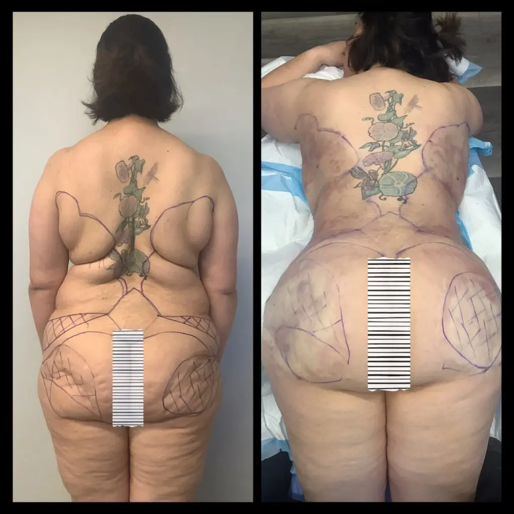 A woman with tattoos on her back and side of body.