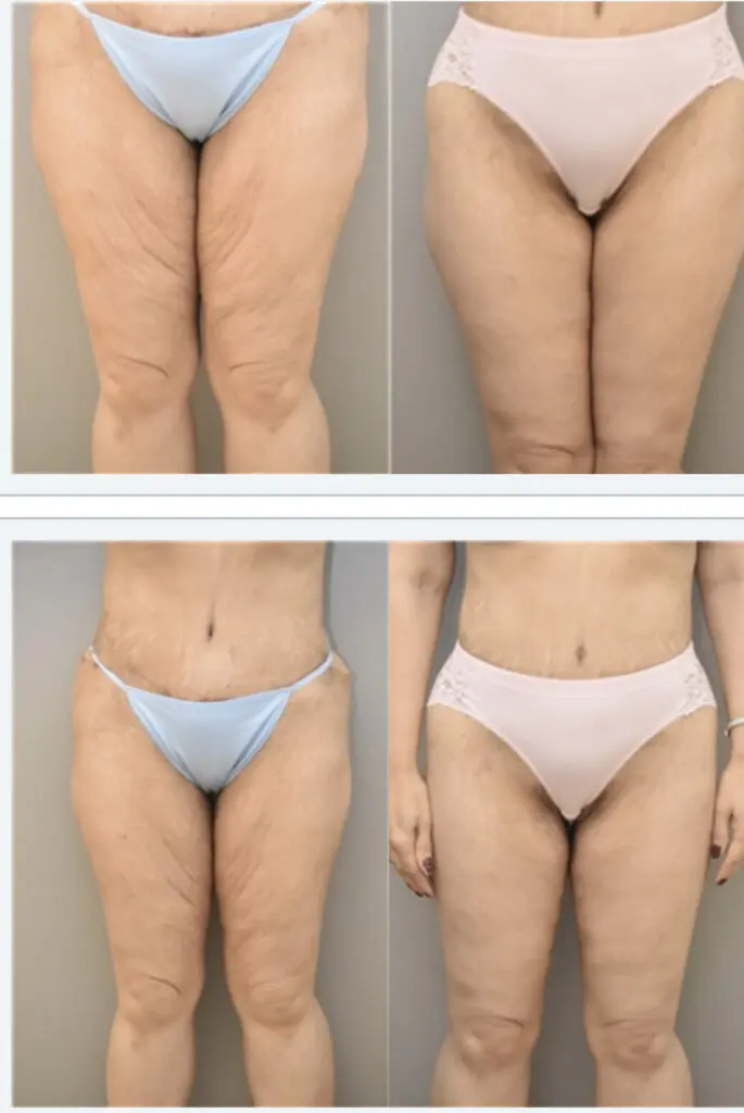 A woman 's legs and buttocks in different colors