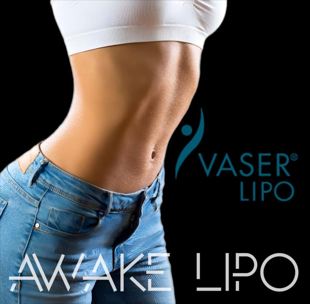 Awake Liposuction